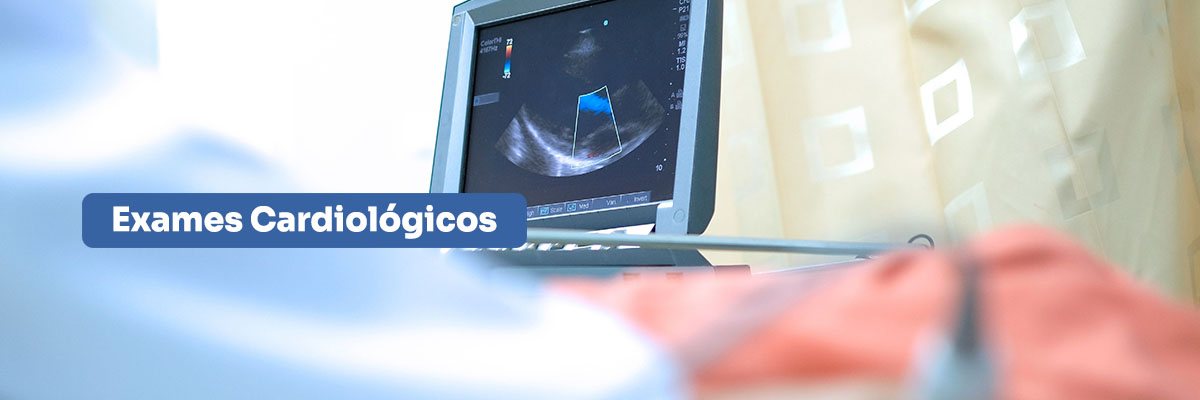 Exames cardiológicos